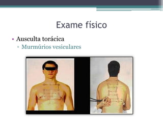Exame físico
• Ausculta torácica
▫ Murmúrios vesiculares
 