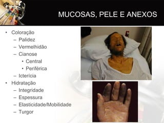 MUCOSAS, PELE E ANEXOS

• Coloração
   – Palidez
   – Vermelhidão
   – Cianose
       • Central
       • Periférica
   – Icterícia
• Hidratação
   – Integridade
   – Espessura
   – Elasticidade/Mobilidade
   – Turgor
 