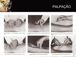 PALPAÇÃO
 