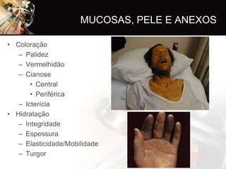 MUCOSAS, PELE E ANEXOS

• Coloração
   – Palidez
   – Vermelhidão
   – Cianose
       • Central
       • Periférica
   – Icterícia
• Hidratação
   – Integridade
   – Espessura
   – Elasticidade/Mobilidade
   – Turgor
 
