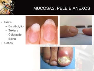 MUCOSAS, PELE E ANEXOS


• Pêlos:
   – Distribuição
   – Textura
   – Coloração
   – Brilho
• Unhas
 