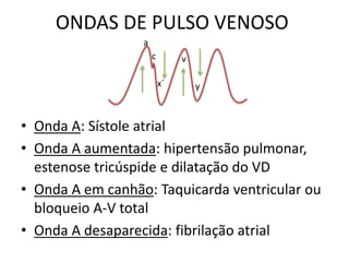 ONDAS DE PULSO VENOSO
• Onda A: Sístole atrial
• Onda A aumentada: hipertensão pulmonar,
estenose tricúspide e dilatação do VD
• Onda A em canhão: Taquicarda ventricular ou
bloqueio A-V total
• Onda A desaparecida: fibrilação atrial
a
c
x`
v
y
 
