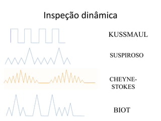 Inspeção dinâmica
KUSSMAUL
SUSPIROSO
CHEYNE-
STOKES
BIOT
 