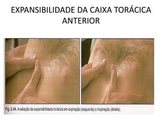 EXPANSIBILIDADE DA CAIXA TORÁCICA
ANTERIOR
 