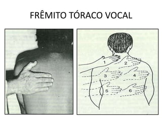 FRÊMITO TÓRACO VOCAL
 