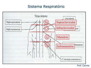 Sistema Respiratório
Prof. Camilo
Mamária
Inframamária
Infraclavicular
Supraclavicular
 