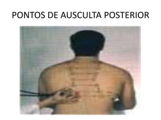 PONTOS DE AUSCULTA POSTERIOR
 