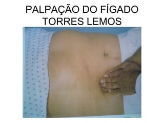 PALPAÇÃO DO FÍGADO
TORRES LEMOS
 