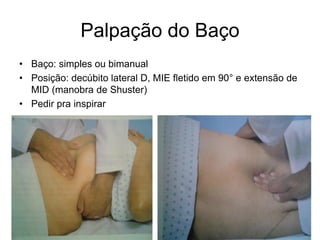 Palpação do Baço
• Baço: simples ou bimanual
• Posição: decúbito lateral D, MIE fletido em 90° e extensão de
MID (manobra de Shuster)
• Pedir pra inspirar
 
