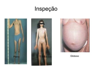 Inspeção
Plano Escavado Globoso
 