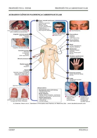 PROPEDÊUTICA - FEPAR PROPEDÊUTICA CARDIOVASCULAR 
ACHADOS CLÍNICOS NA DOENÇA CARDIOVASCULAR 
GESEP 
PÁGINA 6 
