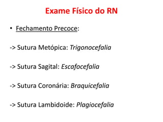 Exame Físico do RN
• Fechamento Precoce:
-> Sutura Metópica: Trigonocefalia
-> Sutura Sagital: Escafocefalia
-> Sutura Coronária: Braquicefalia
-> Sutura Lambidoide: Plagiocefalia
 
