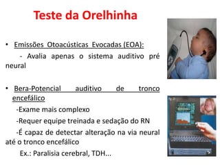 Teste da Orelhinha
• Emissões Otoacústicas Evocadas (EOA):
- Avalia apenas o sistema auditivo pré
neural
• Bera-Potencial auditivo de tronco
encefálico
-Exame mais complexo
-Requer equipe treinada e sedação do RN
-É capaz de detectar alteração na via neural
até o tronco encefálico
Ex.: Paralisia cerebral, TDH...
 
