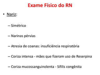 Exame Físico do RN
• Nariz:
– Simétrico
– Narinas pérvias
– Atresia de coanas: insuficiência respiratória
– Coriza intensa - mães que fizeram uso de Reserpina
– Coriza mucossanguinolenta - Sífilis congênita
 