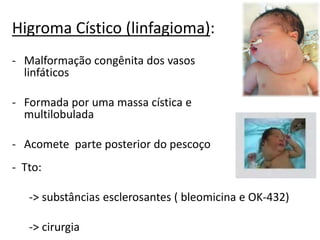 Higroma Cístico (linfagioma):
- Malformação congênita dos vasos
linfáticos
- Formada por uma massa cística e
multilobulada
- Acomete parte posterior do pescoço
- Tto:
-> substâncias esclerosantes ( bleomicina e OK-432)
-> cirurgia
 