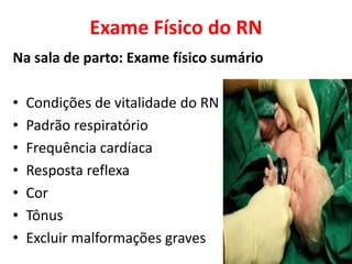 Exame Físico do RN
Na sala de parto: Exame físico sumário
• Condições de vitalidade do RN
• Padrão respiratório
• Frequência cardíaca
• Resposta reflexa
• Cor
• Tônus
• Excluir malformações graves
 
