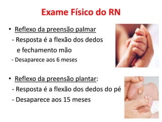 Exame Físico do RN
• Reflexo da preensão palmar
- Resposta é a flexão dos dedos
e fechamento mão
- Desaparece aos 6 meses
• Reflexo da preensão plantar:
- Resposta é a flexão dos dedos do pé
- Desaparece aos 15 meses
 