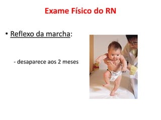 Exame Físico do RN
• Reflexo da marcha:
- desaparece aos 2 meses
 