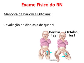 Exame Físico do RN
Manobra de Barlow e Ortolani:
- avaliação de displasia de quadril
 