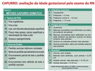 CAPURRO: avaliação do idade gestacional pelo exame do RN
 
