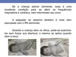 Se a criança estiver dormindo, essa é uma
excelente condição para se aferir as frequências
respiratória e cardíaca, sem interromper seu sono.
A palpação do abdome também é mais bem
executada com o RN dormindo.
Quando a criança abre os olhos, pode-se examiná-
los sem forçar sua abertura; o mesmo se aplica quando
abre a boca.
 