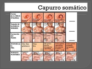 Capurro somático
 
