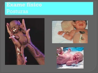 Exame físico
Posturas
 