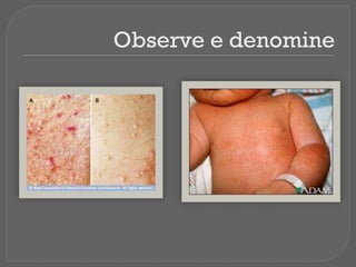 Observe e denomine
 