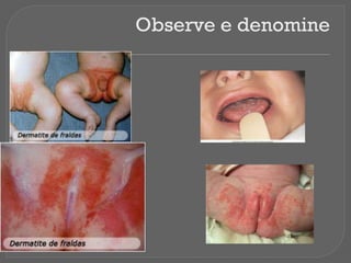 Observe e denomine
 