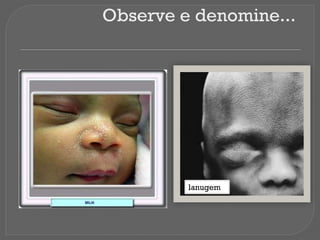 Observe e denomine...
lanugem
 