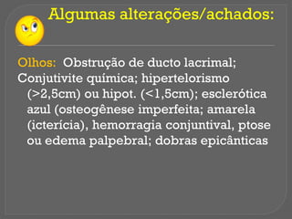 Algumas alterações/achados:
Olhos: Obstrução de ducto lacrimal;
Conjutivite química; hipertelorismo
(>2,5cm) ou hipot. (<1,5cm); esclerótica
azul (osteogênese imperfeita; amarela
(icterícia), hemorragia conjuntival, ptose
ou edema palpebral; dobras epicânticas
 
