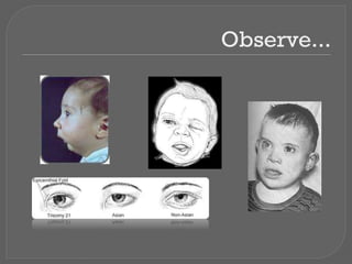 Observe...
 