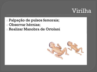 Virilha
⦿ Palpação de pulsos femorais;
⦿ Observar hérnias;
⦿ Realizar Manobra de Ortolani
 