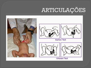 ARTICULAÇÕES
 