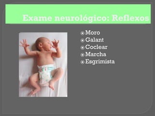 Exame neurológico: Reflexos
⦿ Moro
⦿ Galant
⦿ Coclear
⦿ Marcha
⦿ Esgrimista
 