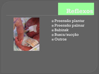 Reflexos
⦿ Preensão plantar
⦿ Preensão palmar
⦿ Babinsk
⦿ Busca/sucção
⦿ Outros
 