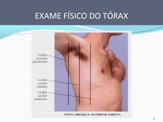 EXAME FÍSICO DO TÓRAX
 