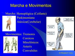 Marcha e Movimentos
Marcha: Hemeplégica (Ceifante)
Parkinsoniana
Atáxica(Cerebelar)
Movimentos: Tremores
Coreicos
Mioclônicos
Asterix
Convulsões
Dr Ricardo F. Cury
 