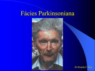 Fácies Parkinsoniana
Dr Ricardo F. Cury
 