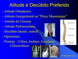 Atitude e Decúbito Preferido
- Atitude Ortopneica
- Atitude Genupeitoral ou “Prece Maometana”
- Atitude de Cócoras
- Atitude Parkinsoniana
- Decúbito lateral, ventral
- Opistótono
- Postura – Cifose, lordose, Escoliose,
Cifoescoliose
Dr Ricardo F. Cury
 