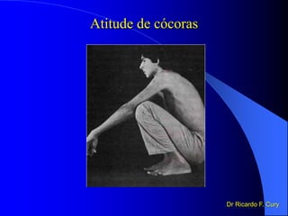 Atitude de cócoras
Dr Ricardo F. Cury
 