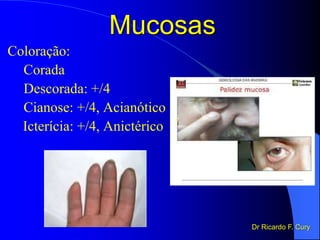 Mucosas
Coloração:
Corada
Descorada: +/4
Cianose: +/4, Acianótico
Icterícia: +/4, Anictérico
Dr Ricardo F. Cury
 