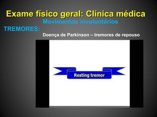 Exame físico geral: Clínica médicaExame físico geral: Clínica médica
Movimentos involuntários
TREMORES:
Doença de Parkinson – tremores de repouso
 