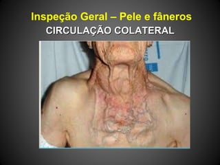 Inspeção Geral – Pele e fâneros
CIRCULAÇÃO COLATERALCIRCULAÇÃO COLATERAL
 