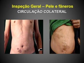 Inspeção Geral – Pele e fâneros
CIRCULAÇÃO COLATERALCIRCULAÇÃO COLATERAL
 