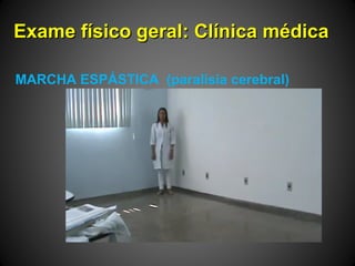 Exame físico geral: Clínica médicaExame físico geral: Clínica médica
MARCHA ESPÁSTICA (paralisia cerebral)
 