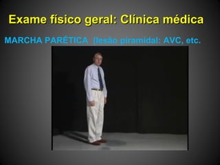 Exame físico geral: Clínica médicaExame físico geral: Clínica médica
MARCHA PARÉTICA (lesão piramidal: AVC, etc.
 