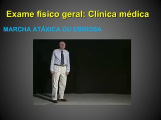 Exame físico geral: Clínica médicaExame físico geral: Clínica médica
MARCHA ATÁXICA OU EBRIOSA
 