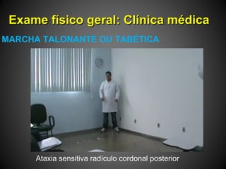 Exame físico geral: Clínica médicaExame físico geral: Clínica médica
MARCHA TALONANTE OU TABÉTICA
Ataxia sensitiva radículo cordonal posterior
 