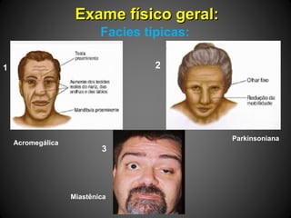 Exame físico geral:Exame físico geral:
Facies típicas:
Miastênica
1 2
3
Acromegálica
Parkinsoniana
2
 